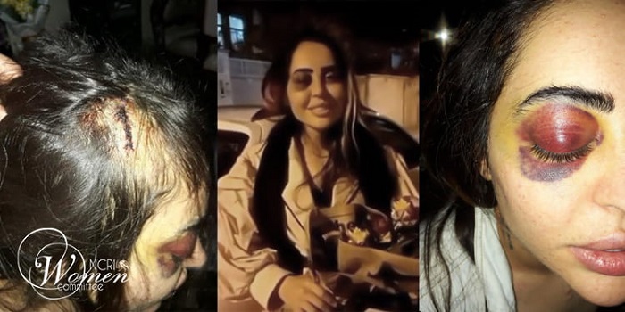 Yaghoubi's arrest and subsequent mistreatment have sparked outrage, with activists and organizations calling for her release and for an end to the mistreatment of prisoners.