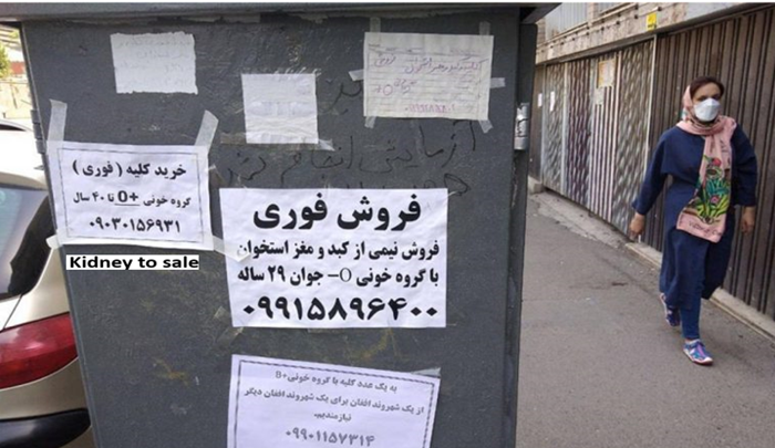 In a disturbing trend that reveals the depths of economic despair in Iran, young Iranians, stifled by the mullahs’ regime, are resorting to selling their organs on the black market.